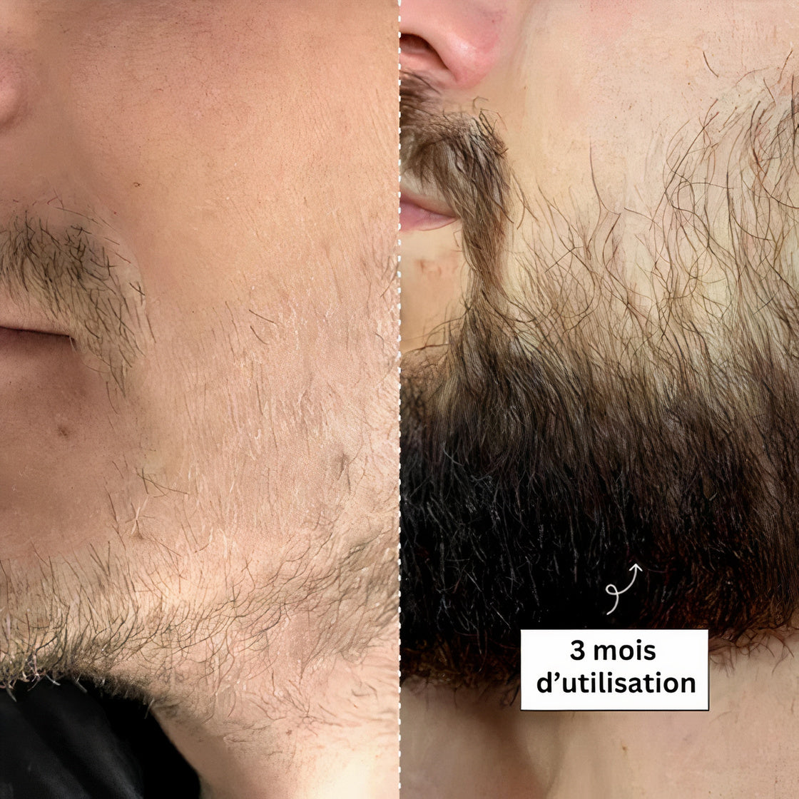 Sérum Thorin | Huile de croissance de Barbe