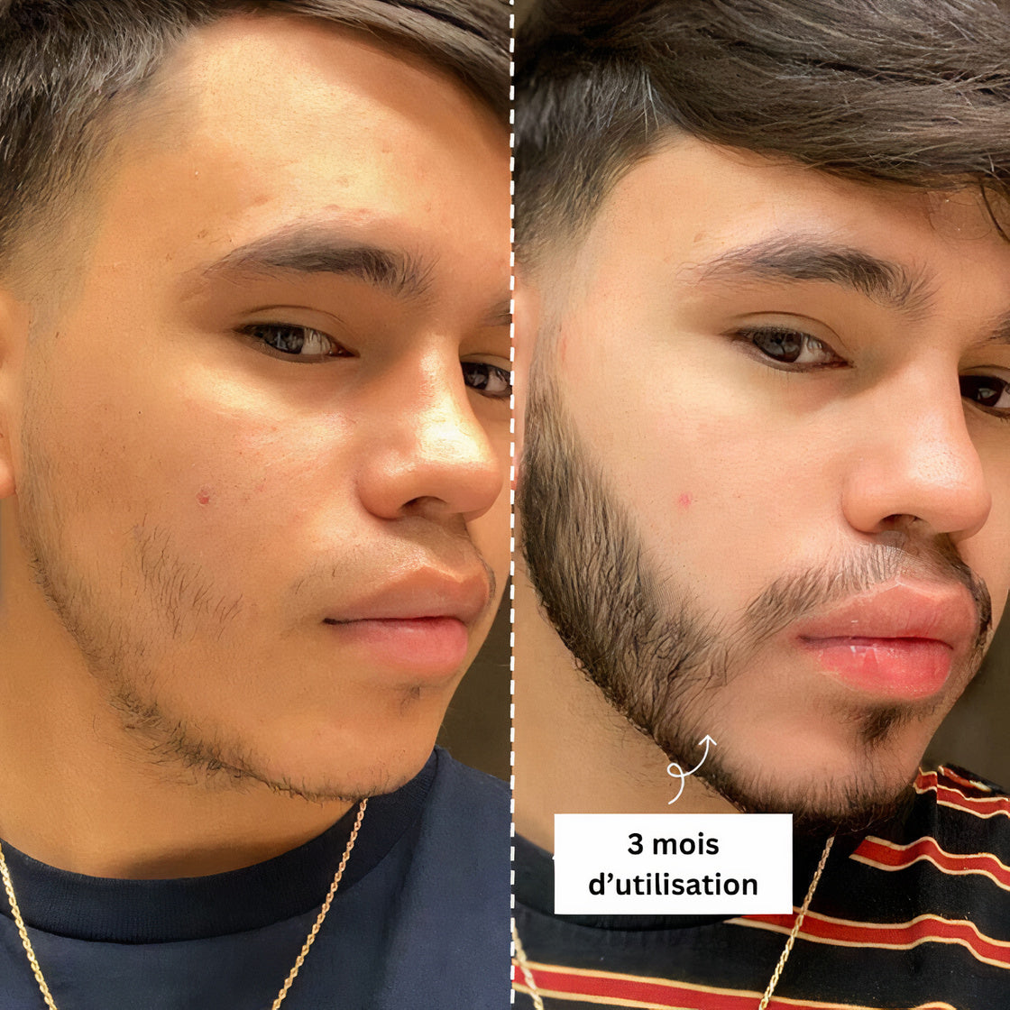 Sérum Thorin | Huile de croissance de Barbe