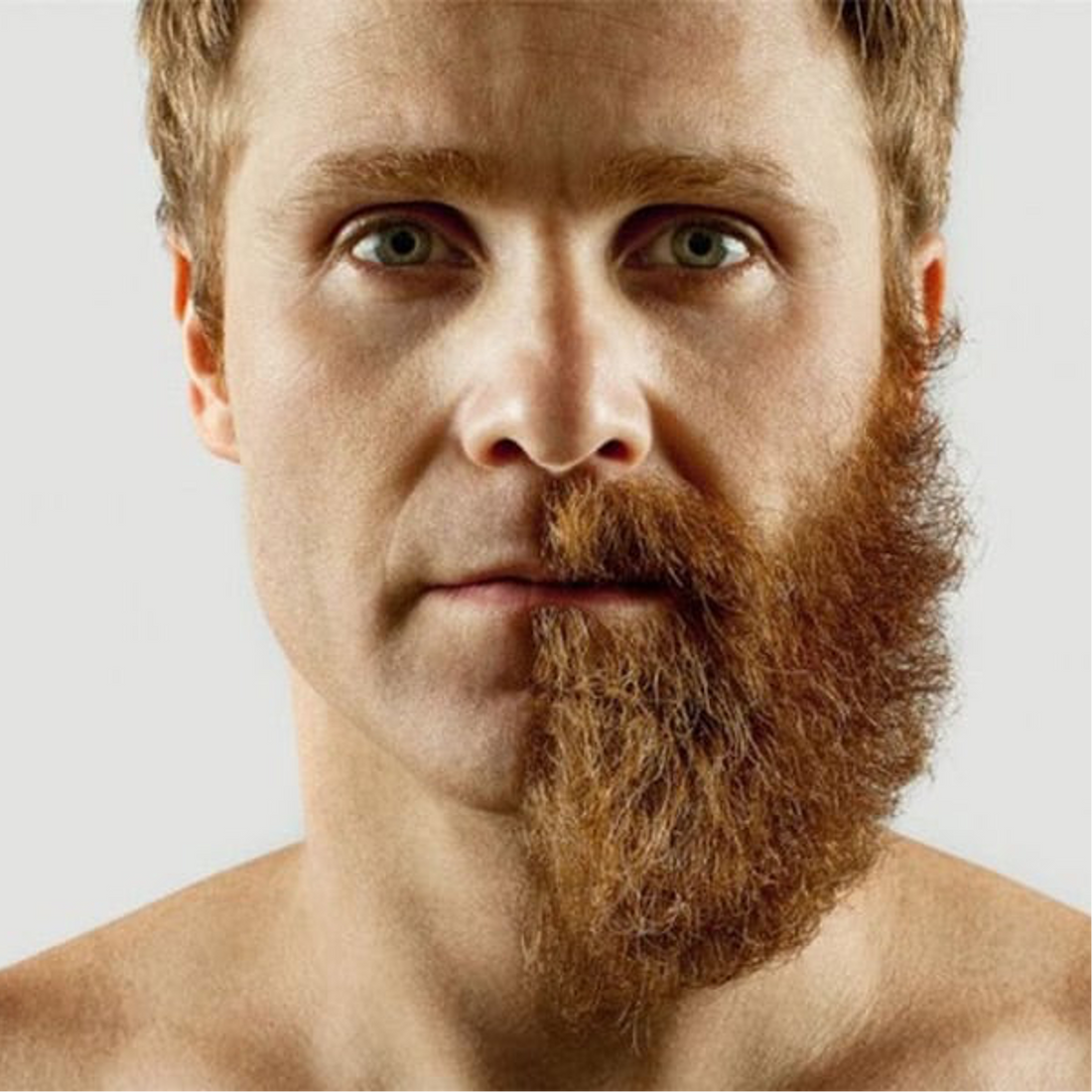 la testostérone fait-elle pousser la barbe ?