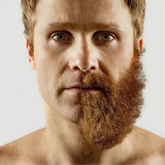 La testostérone fait-elle pousser la barbe ?