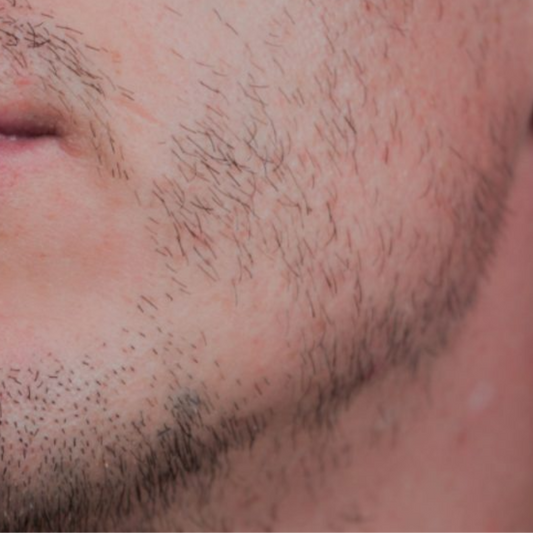 Comment remédier à une barbe parsemée ?