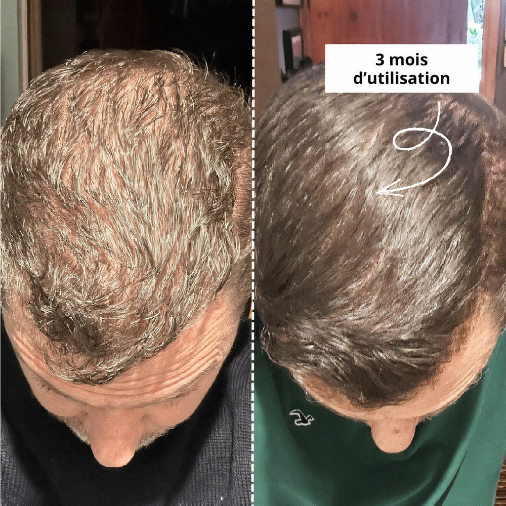 Shampoing Anti Chute Homme au Baicapil ®