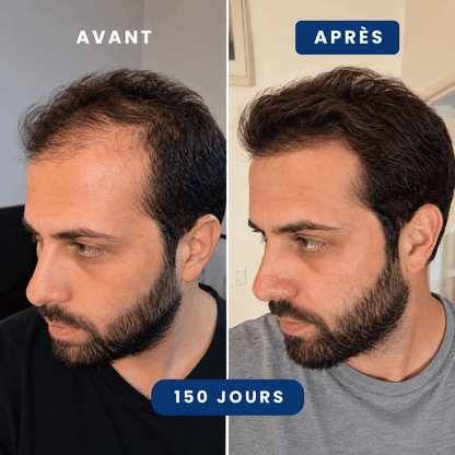 Kit Anti-Chute Cheveux Homme | Odin - Max Barber