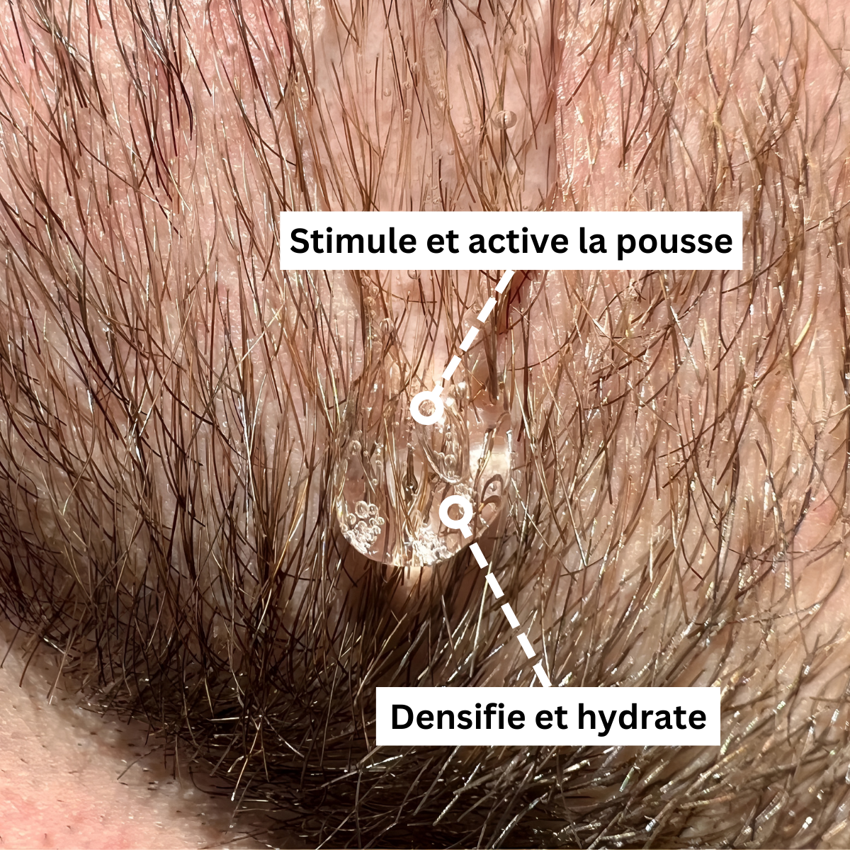 Activator Serum | Booster Croissance de barbe