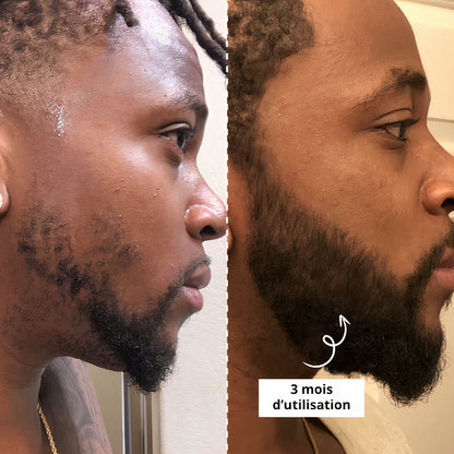 Activator Serum | Booster Croissance de barbe