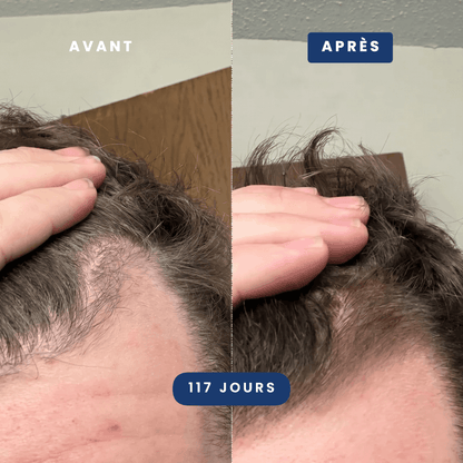 Pack Anti-Chute Cheveux Homme | Odin - Max Barber