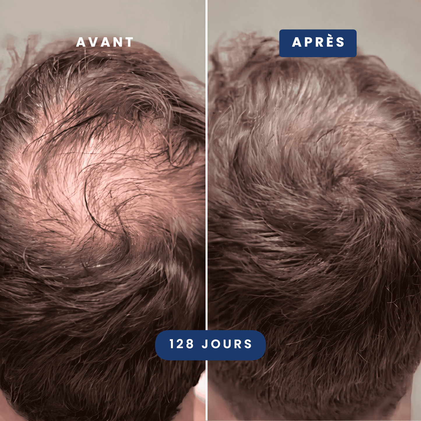 Pack Anti-Chute Cheveux Homme | Odin - Max Barber
