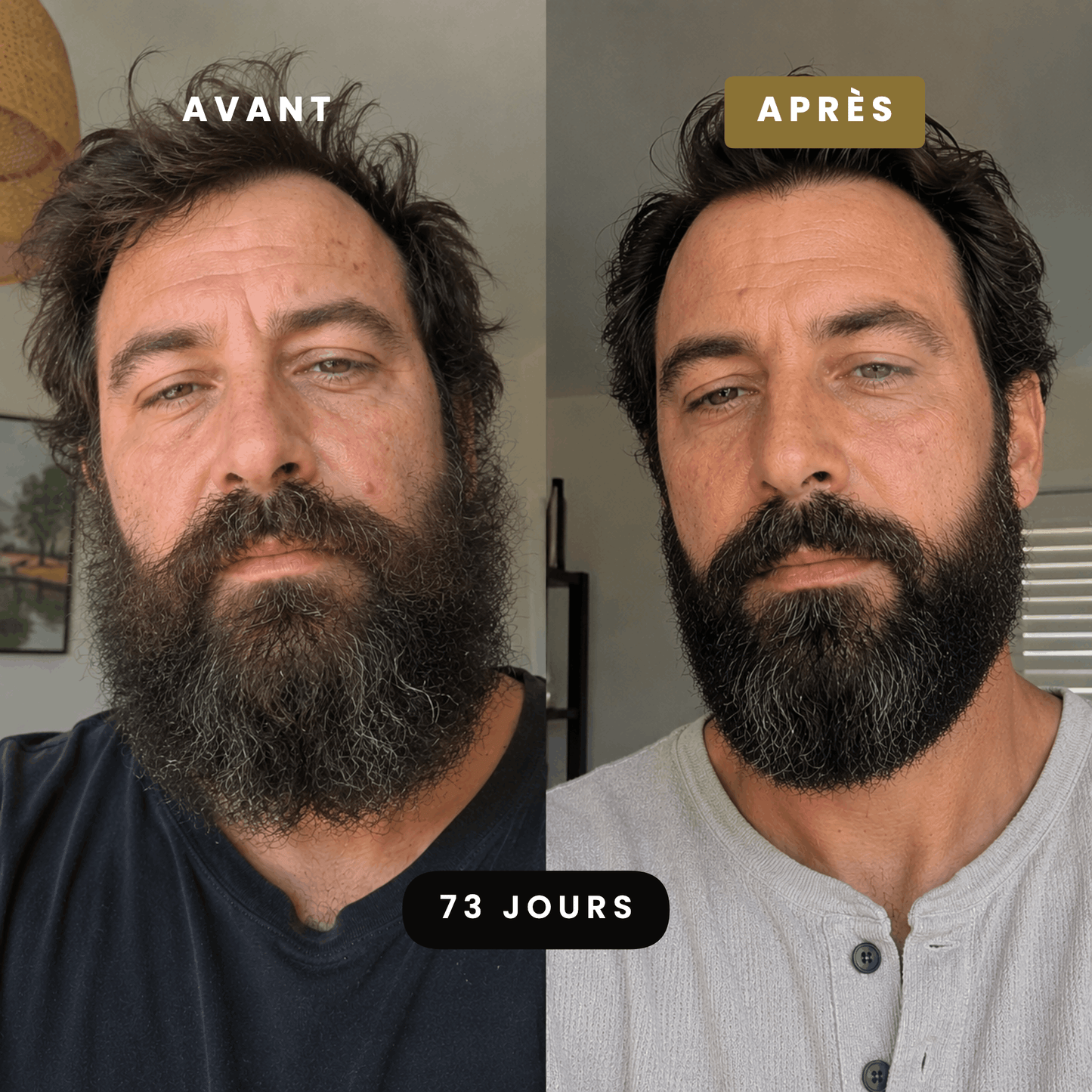 Coffret Soin Barbe Homme Complet 4-en-1 | Les Trésors d'Asgard