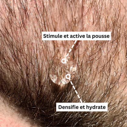Activator Serum | Booster Croissance de barbe