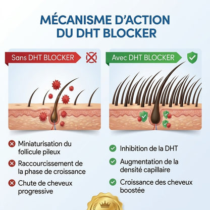 DHT Blocker : Bloqueur de DHT Naturel | Saw Palmetto 320 mg | Max-Barber